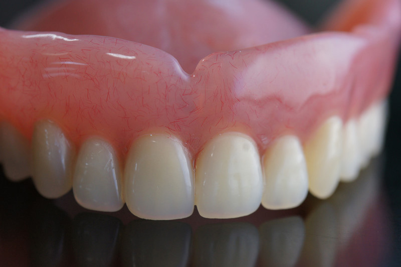 immediate dentures