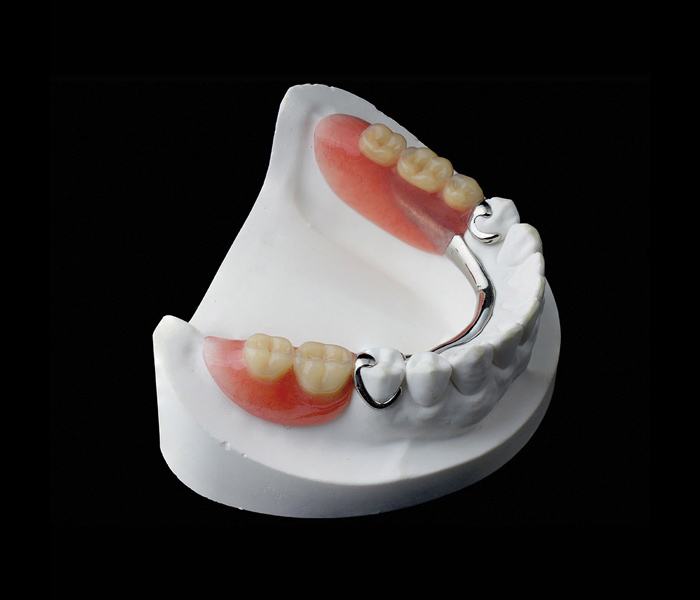 partial denture