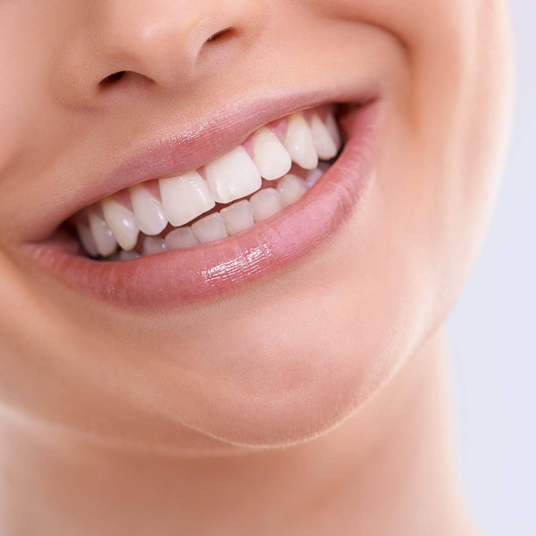 Veneers Bethedsa Washington DC