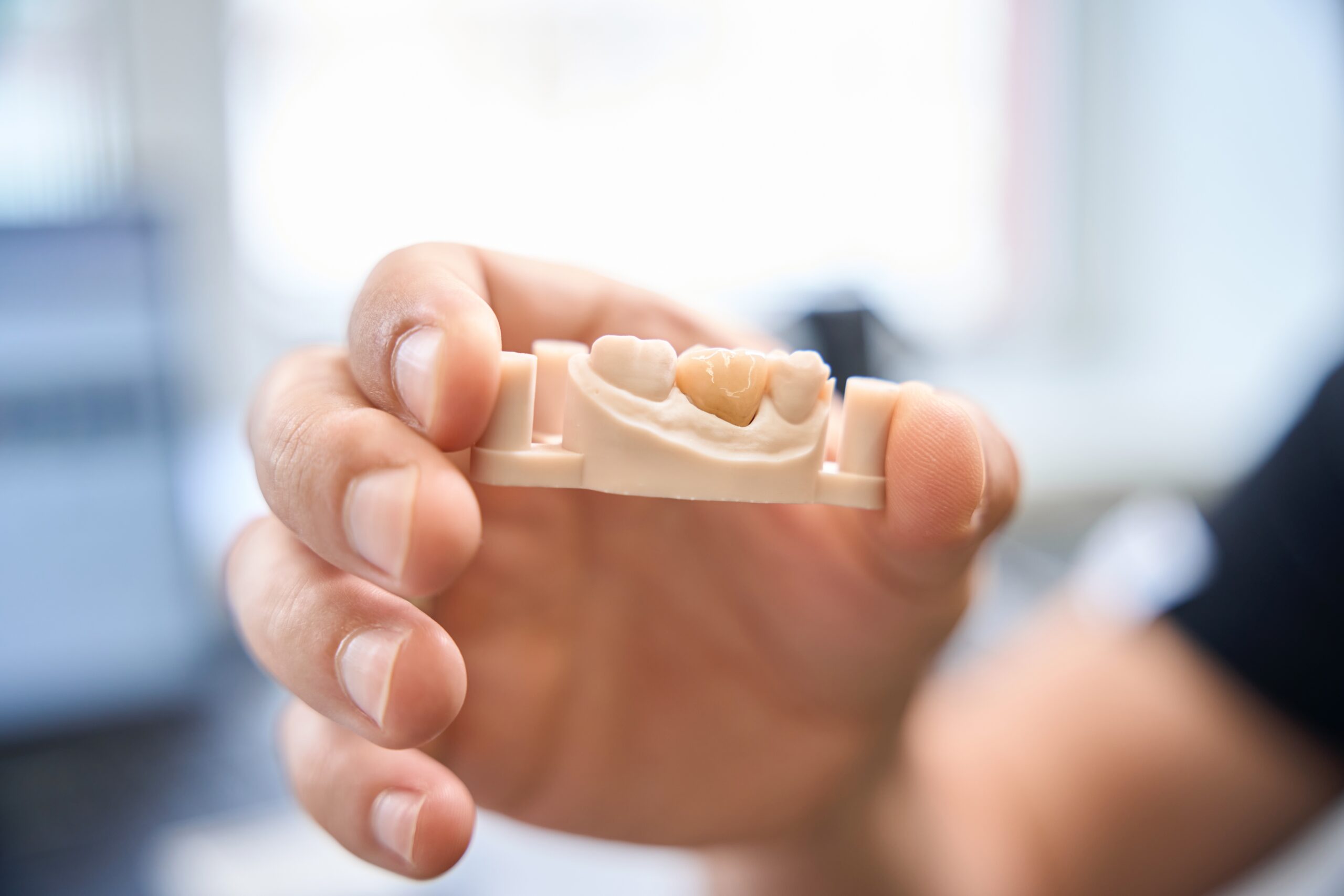 What Types of Dental Crowns Are Available?